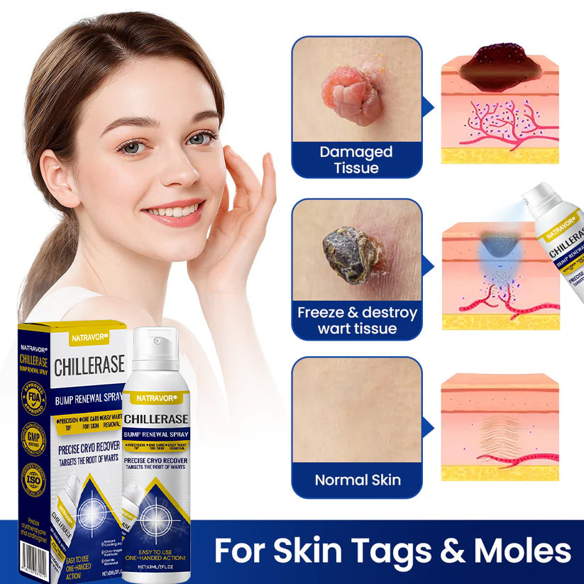 Natravor® ChillErase Bump Renewal Spray🇺🇸👨‍⚕️⚕️ FDA Certified （Zero Pain, Smooth Skin | Flatten Bumps Fast | Calm Redness & Irritation | ）🔥🎁