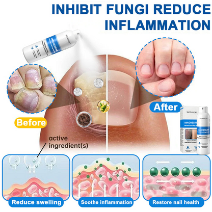 🔥 Natravor® Magnesium Spray – Fast Relief for Itchy, Red & Sensitive Skin (Even Intimate Areas)