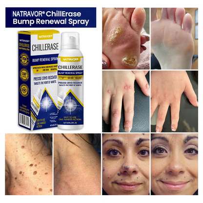 Natravor® ChillErase Bump Renewal Spray🇺🇸👨‍⚕️⚕️ FDA Certified （Zero Pain, Smooth Skin | Flatten Bumps Fast | Calm Redness & Irritation | ）🔥🎁