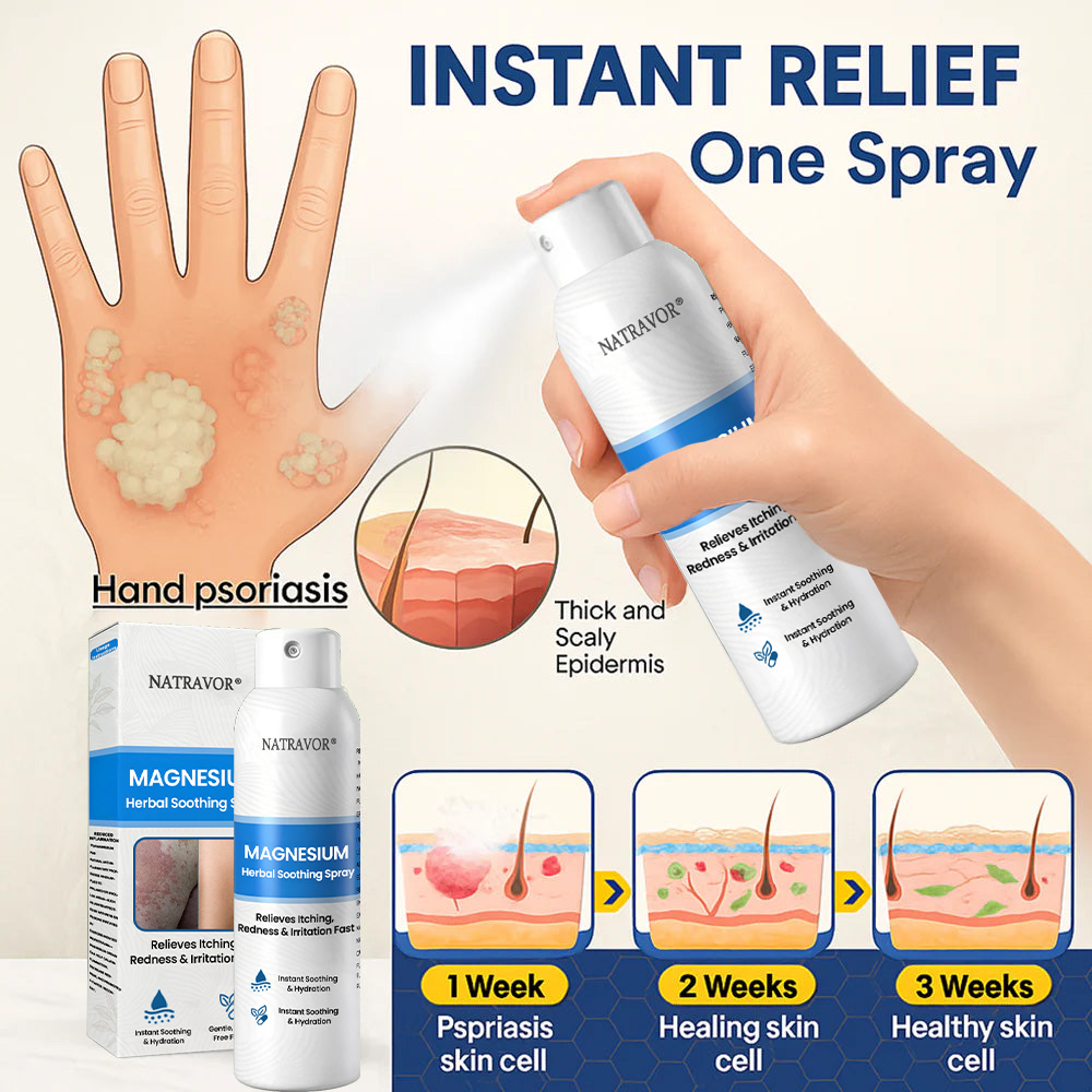 🔥 Natravor® Magnesium Spray – Fast Relief for Itchy, Red & Sensitive Skin (Even Intimate Areas)