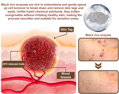 Natravor® Black Rice Skin Repair Essence Cream ⚕️ FDA Certified (Removes warts and skin growths, improves keratin buildup and seborrheic dermatitis, follicular keratosis, age spots, and bruising)